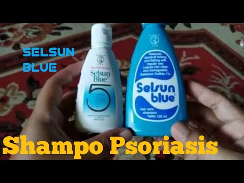 Tips Mengatasi Psoriasis Dengan Shampo Selsun Blue Youtube