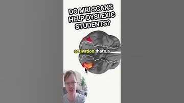 DO #MRI SCANS HELP #DYSLEXIC #STUDENTS