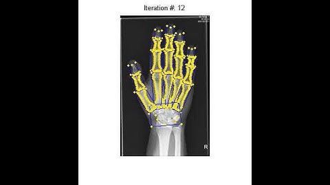 VEMERA - Segmentation of hand