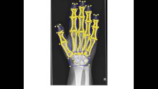 Famous VEMERA - Segmentation of hand Net Worth