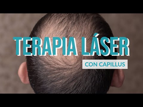 Vídeo: Tratamiento Con Láser Para La Pérdida Del Cabello: ¿funciona?