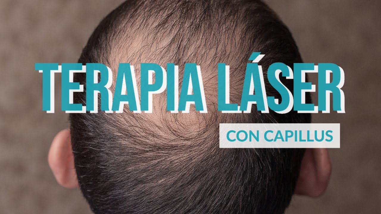 TRATAMIENTO PARA CAÍDA DE CABELLO O ALOPECIA