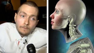 What Happened To The First Human Head Transplant? (Feat. Medlife Crisis) screenshot 5