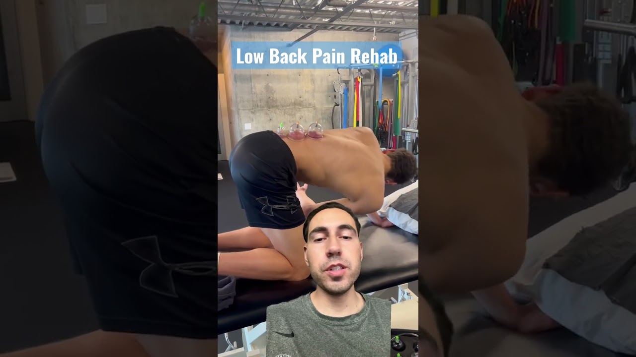 Low back pain: cupping therapy 