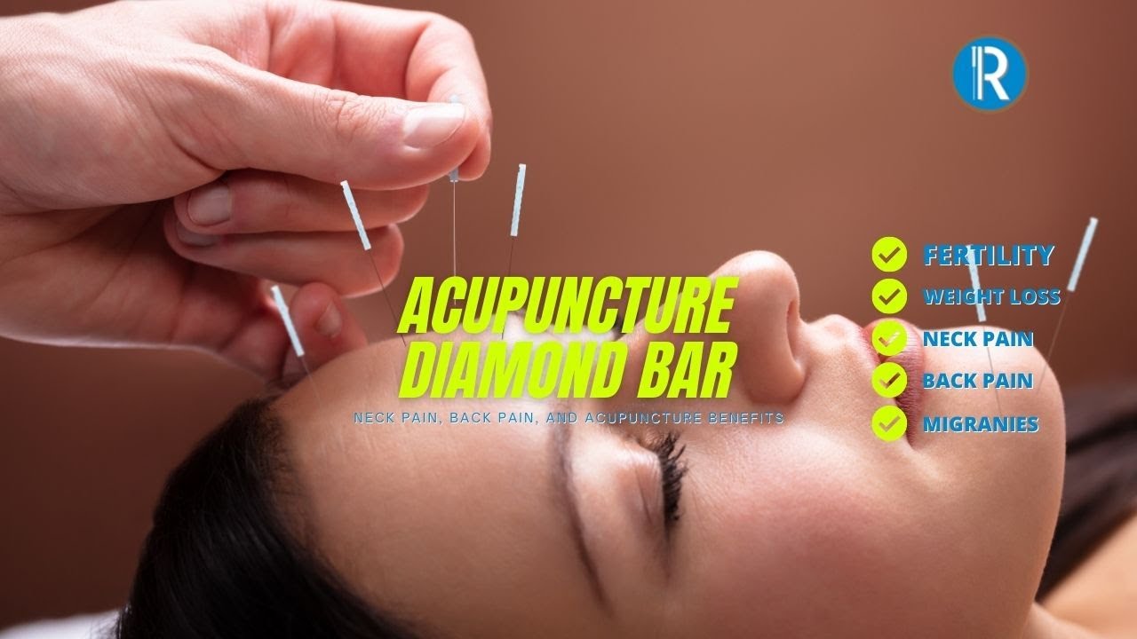 Rivernorth Modern Acupuncture Clinic Near Me in Diamond ...