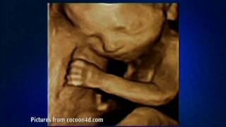 Cocoon4D 3D Baby Scan on The Wright Stuff