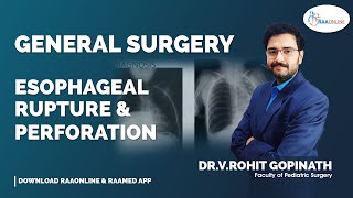 General Surgery | Esophageal Rupture and Perforation | By Dr.Rohit Gopinath | Raaonline General Surgery | Esophageal Rupture and Perforation | By Dr.Rohit Gopinath | Raaonline