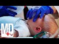 Is This Baby With Intracerebral Hemorrhage Being Abused by Mother? | Chicago Med | MD TV