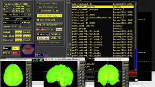 Milwaukee AFNI Workshop, Part 3: Checking Preprocessing
