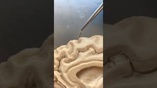 Real Human Brain Gray & White Matter