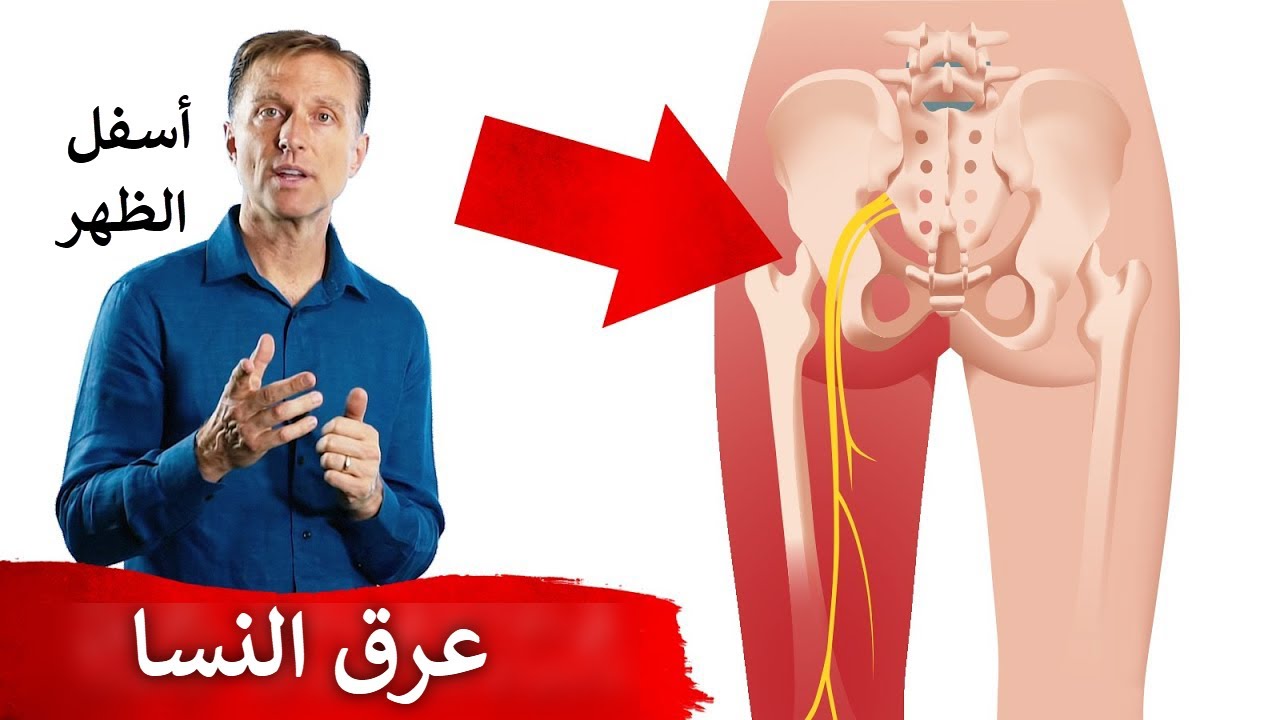 أفضل علاج طبيعي يساعد ألم أسفل الظهر (عرق النسا)