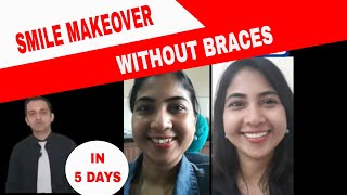 What is smile makeover -True story of amazing smile transformation|how is smile correction done?