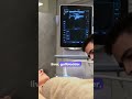 Abdominal Ultrasound