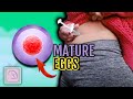 How to mature your eggs for IVF