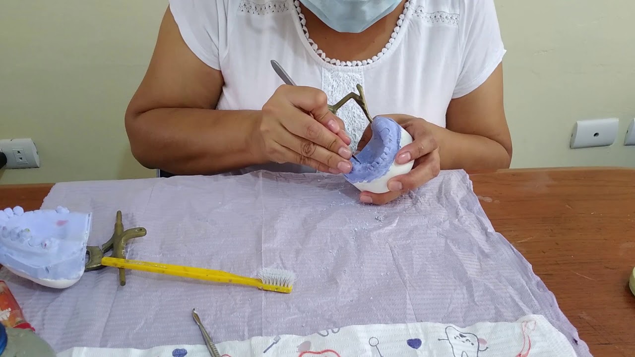 Provisional (autocurado)- parte 2