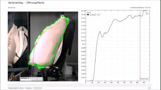 ARAMIS Contour Tracking