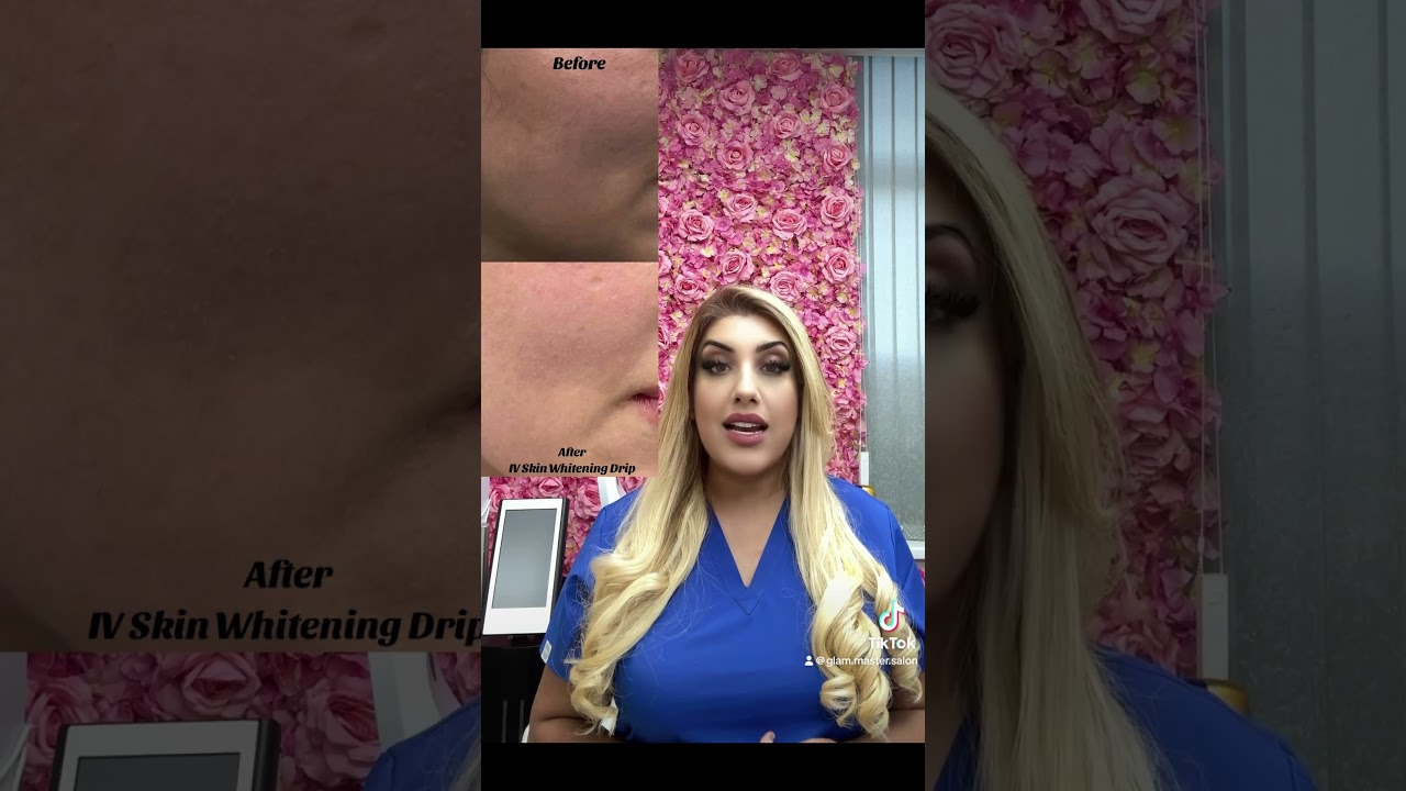 IV Skin Whitening Brightening Drip Manchester at Glam Master Salon Aesthetics & Spa 01612329601