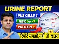 Urine Report Kaise Padhe? | Normal Range | Pus Cells, RBC, Protein Kya Matlab । Peshab me jalan 