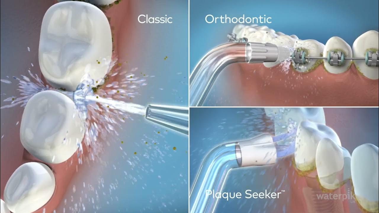 Naujasis Waterpik Cordless Plus WP 490 - YouTube