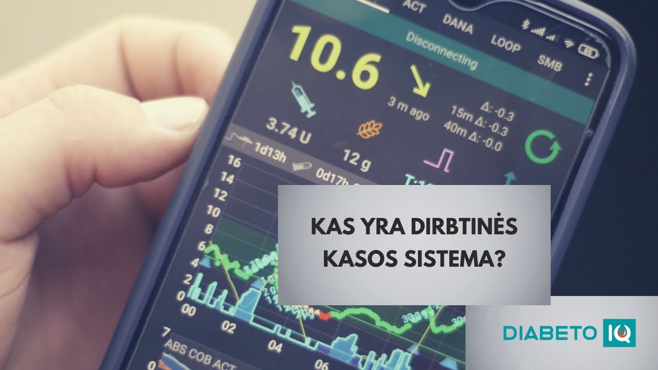 Kas yra dirbtinės kasos sistema? „Diabeto IQ“ YouTube