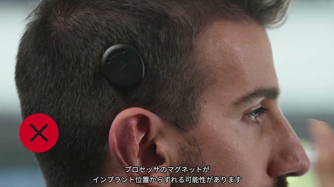 Nucleus® Kanso® 3サウンドプロセッサを組み立てて電源を入れる