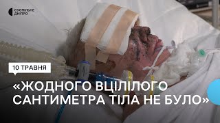 «Ракета знищила і тіло, і обличчя, і очі» Лікують поранену жінку після обстрілу Костянтинівки