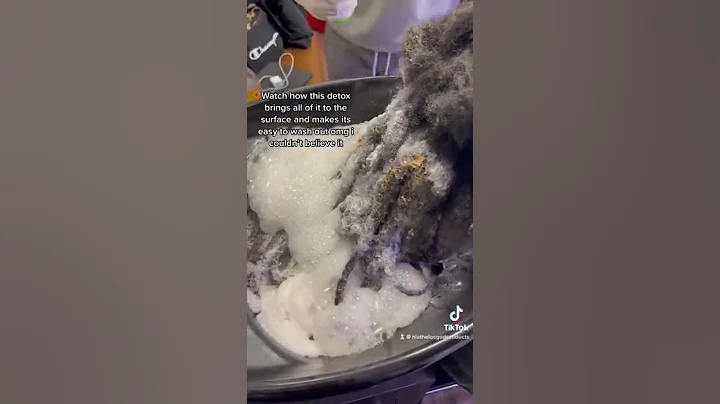 OMG‼️😱 So Much Dandruff Build Up‼️ The Loc God Detox