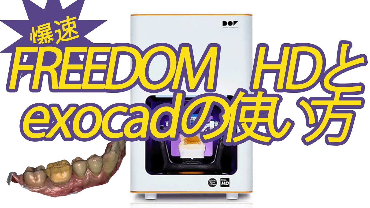 【歯科技工】爆速スキャンでCADCAM冠を作る