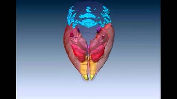 3D brain reconstruction & surface rendering (Partial reconstruction)