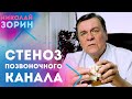 Стеноз позвоночного канала