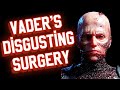 The HORRIFYING Surgery Anakin Went through to become Vader! (Star Wars Explained)