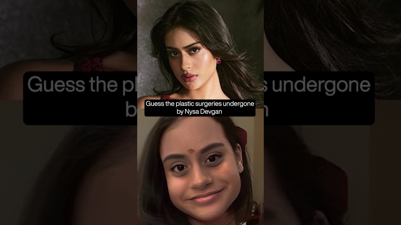 How many surgeries has Nysa Devgn undergone?