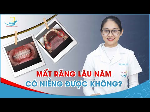 vệ sinh răng niềng tại Kemtrinam.vn