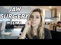 Jaw surgery week 3: having a hard time & going home