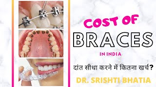 COST of BRACES in India; Braces se Daant sidhe karne me kitna kharcha aega? Dr. Srishti Bhatia