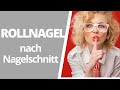 Rollnagel nach falschem Nagelschnitt #eingewachsener Nagel #Rollnagel #Nagelschnitt