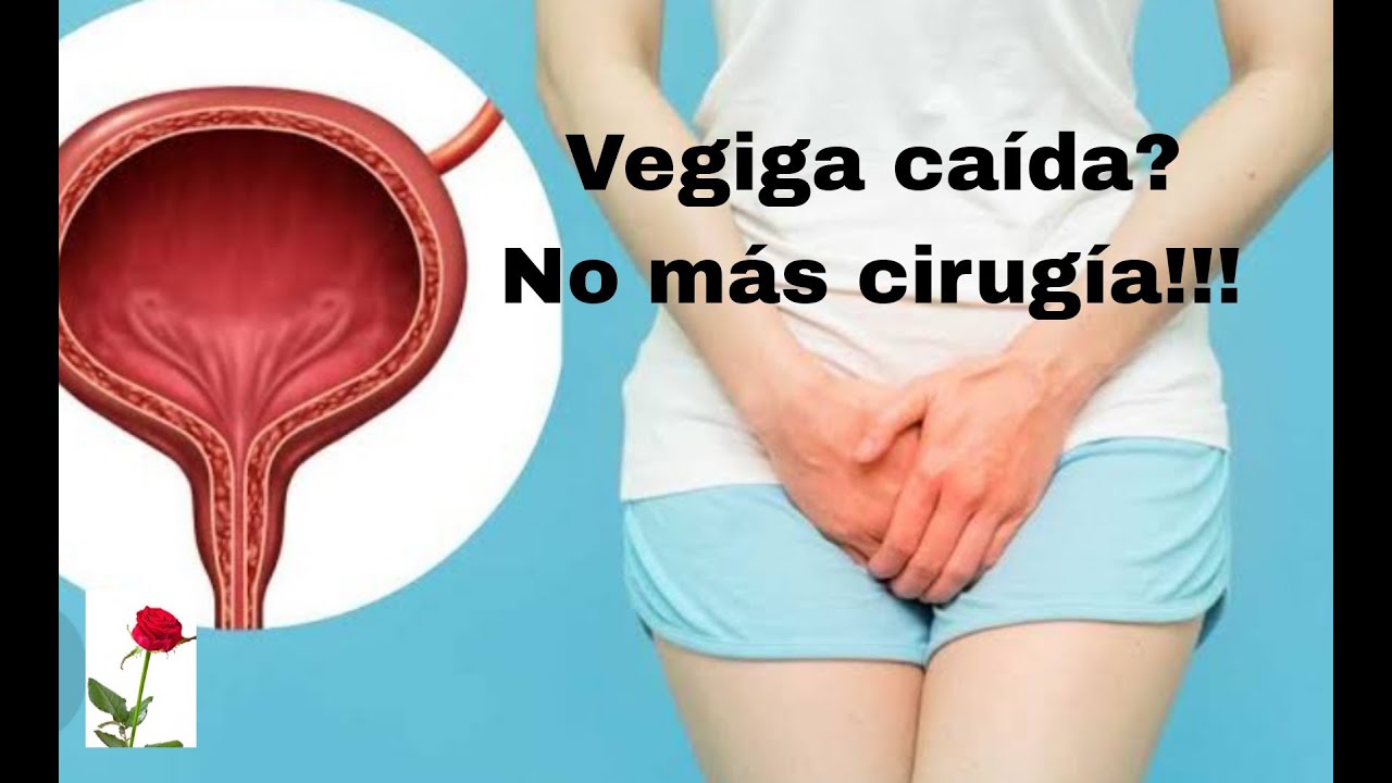 Como Se Acomoda La Vejiga Caida