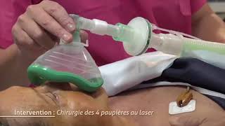 Chirurgie des 4 paupières au Laser - Dr Bernard Hayot