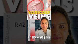 Best Homeopathic Drops For Varicose Veins Leg Heaviness Dr. Reckeweg R42 Benefits