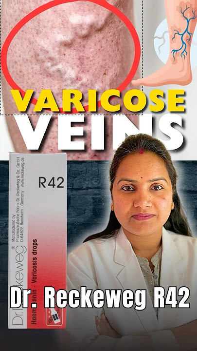 Best Homeopathic Drops for Varicose Veins & Leg Heaviness | Dr. Reckeweg R42 Benefits