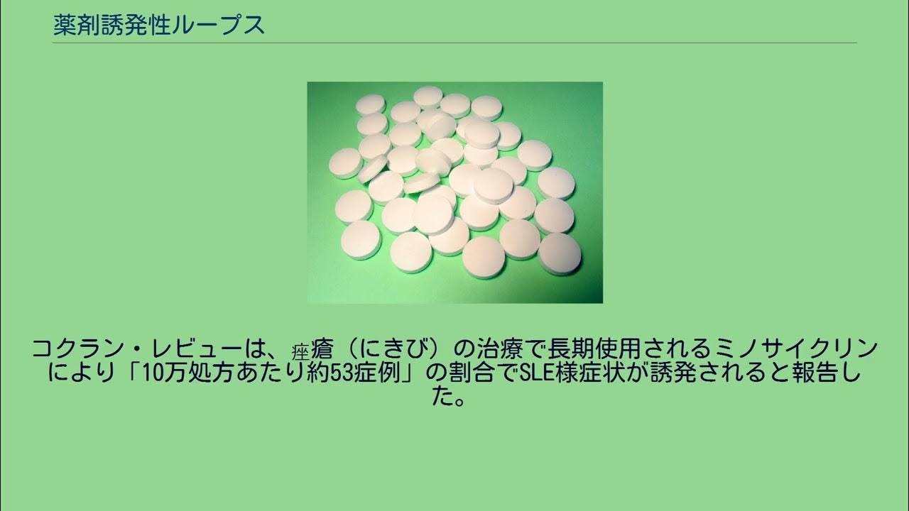 薬剤誘発性ループス YouTube