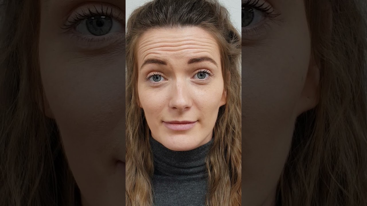 Ever Clinic - Before Botox