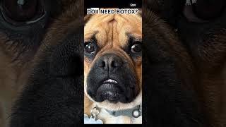 Do I need Botox?