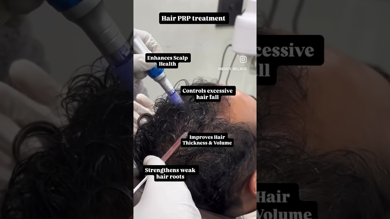 | Hair PRP Treatment | 