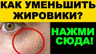 Как уменьшить жировик без операции: секрет китайских точек
