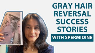 Gray Hair Reversal Success Stories with Spermidine