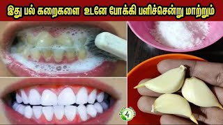 இது பல் கறைகளை போக்கி பல்லை பளிச்சென்று மாற்றும் TEETH WHITE HOME REMEDY
