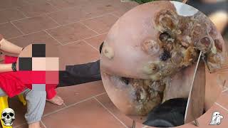 Extreme Jigger Infestation – Unexpected Deep Tissue Impact! #HN457