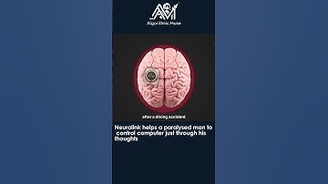 Neuralink helps a paralysed man to control computer just through his thoughts 😮🧠 #neuralink