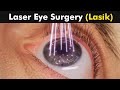 How Laser Eye Surgery (Lasik) is Performed? | 3D Animation (Urdu/Hindi)